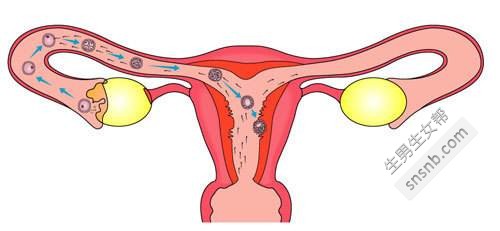 排卵障碍导致的不孕不育的最常见原因是什么？