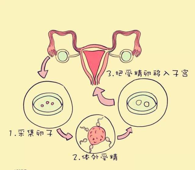 你想在天津做试管婴儿来怀上双胞胎吗？首先，你需要知道这些要点